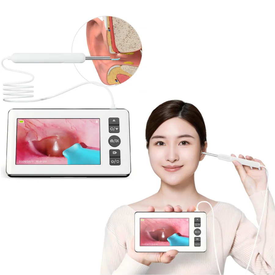 4.3" Screen Visual Ear Cleaner